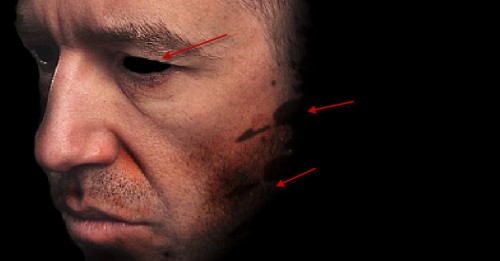 2 erase eye 500x261 Design an Interesting Human Face Manipulation with Tree Roots Texture in Photoshop